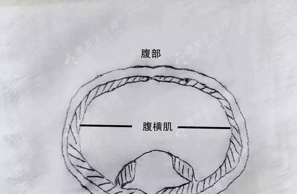 5步教你快速解决电脑卡顿问题？如何优化系统性能？  第3张